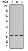 MAPK14 / p38 Antibody - Western blot analysis of p38 expression in HEK293T (A); HepG2 (B); K562 (C) whole cell lysates.