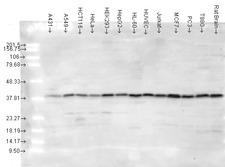 MAPK14 / p38 Antibody - Multi-blot analysis of p38 in a cell lysate from 12 human cancer cell lines using a 1:1000 dilution of MAPK14 / p38 antibody.