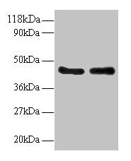 MAPK14 / p38 Antibody - Western blot All lanes: Activator of 90 kDa heat shock protein ATPase homolog 1 antibody at 2µg/ml Lane 1: EC109 whole cell lysate Lane 2: 293T whole cell lysate Secondary Goat polyclonal to rabbit IgG at 1/15000 dilution Predicted band size: 39, 33 kDa Observed band size: 45 kDa