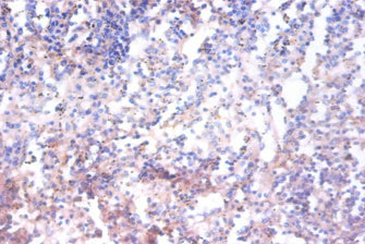 MAPK14 / p38 Antibody - Immunohistochemistry of paraffin-embedded human spleen tissue using AHSA1 Antibody at dilution of 1:100