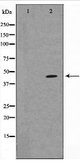 MAPK14 / p38 Antibody - Western blot of p38 MAPK expression in 293 whole cell lysates,The lane on the left is treated with the antigen-specific peptide.