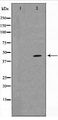 MAPK14 / p38 Antibody - Western blot of p38 MAPK expression in 293 whole cell lysates,The lane on the left is treated with the antigen-specific peptide.