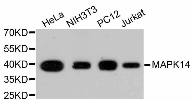 MAPK14 / p38 Antibody - Western blot analysis of extracts of various cell lines, using MAPK14 antibody. The secondary antibody used was an HRP Goat Anti-Rabbit IgG (H+L) at 1:10000 dilution. Lysates were loaded 25ug per lane and 3% nonfat dry milk in TBST was used for blocking.