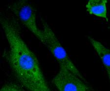 MAPK14 / p38 Antibody - Immunofluorescence analysis of NIH-3T3 cells using MAPK14 antibody.