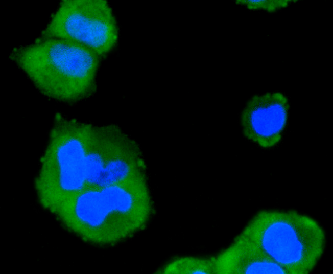 MAPK14 / p38 Antibody - Immunofluorescence analysis of HeLa cells using MAPK14 antibody.