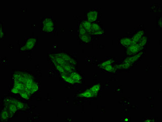 MAPK14 / p38 Antibody - Immunofluorescent analysis of HepG2 cells using MAPK14 Antibody at a dilution of 1:100 and Alexa Fluor 488-congugated AffiniPure Goat Anti-Rabbit IgG(H+L)