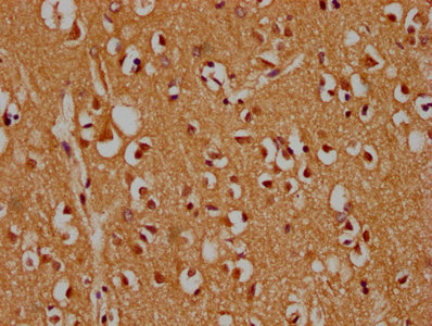 MAPK14 / p38 Antibody - IHC image of MAPK14 Antibody diluted at 1:300 and staining in paraffin-embedded human brain tissue performed on a Leica BondTM system. After dewaxing and hydration, antigen retrieval was mediated by high pressure in a citrate buffer (pH 6.0). Section was blocked with 10% normal goat serum 30min at RT. Then primary antibody (1% BSA) was incubated at 4°C overnight. The primary is detected by a biotinylated secondary antibody and visualized using an HRP conjugated SP system.
