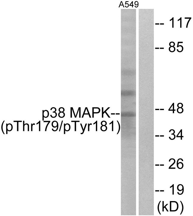 MAPK14 / p38 Antibody - Western blot analysis of lysates from A549 cells treated with etoposide 25uM 24hours, using p38 MAPK (Phospho-Thr179+Tyr181) Antibody. The lane on the right is blocked with the phospho peptide.