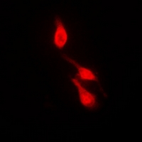 MAPK14 / p38 Antibody - Immunofluorescent analysis of p38 (pY182) staining in HepG2 cells. Formalin-fixed cells were permeabilized with 0.1% Triton X-100 in TBS for 5-10 minutes and blocked with 3% BSA-PBS for 30 minutes at room temperature. Cells were probed with the primary antibody in 3% BSA-PBS and incubated overnight at 4 deg C in a humidified chamber. Cells were washed with PBST and incubated with a DyLight 594-conjugated secondary antibody (red) in PBS at room temperature in the dark. DAPI was used to stain the cell nuclei (blue).