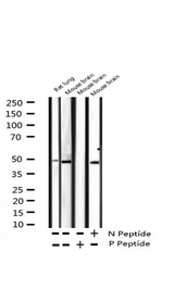 MAPK14 / p38 Antibody - Western blot analysis of Phospho-p38 MAPK (Tyr182) expression in various lysates