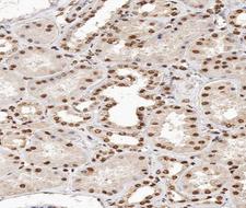 MAPK14 / p38 Antibody - 1:200 staining human kidney tissue by IHC-P. The tissue was formaldehyde fixed and a heat mediated antigen retrieval step in citrate buffer was performed. The tissue was then blocked and incubated with the antibody for 1.5 hours at 22°C. An HRP conjugated goat anti-rabbit antibody was used as the secondary.