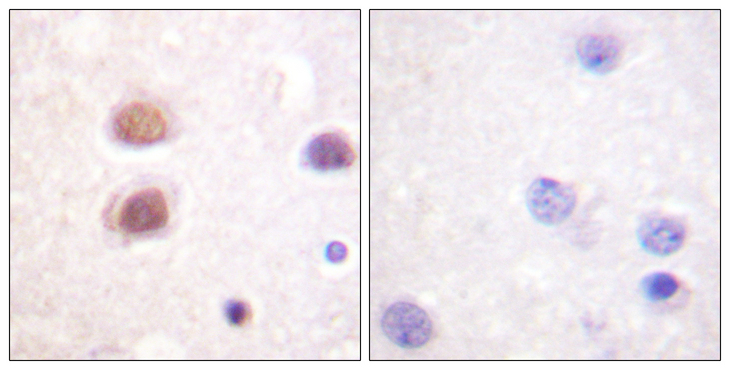 MAPK14 / p38 Antibody - Immunohistochemistry analysis of paraffin-embedded human brain, using p38 MAPK (Phospho-Tyr322) Antibody. The picture on the right is blocked with the phospho peptide.