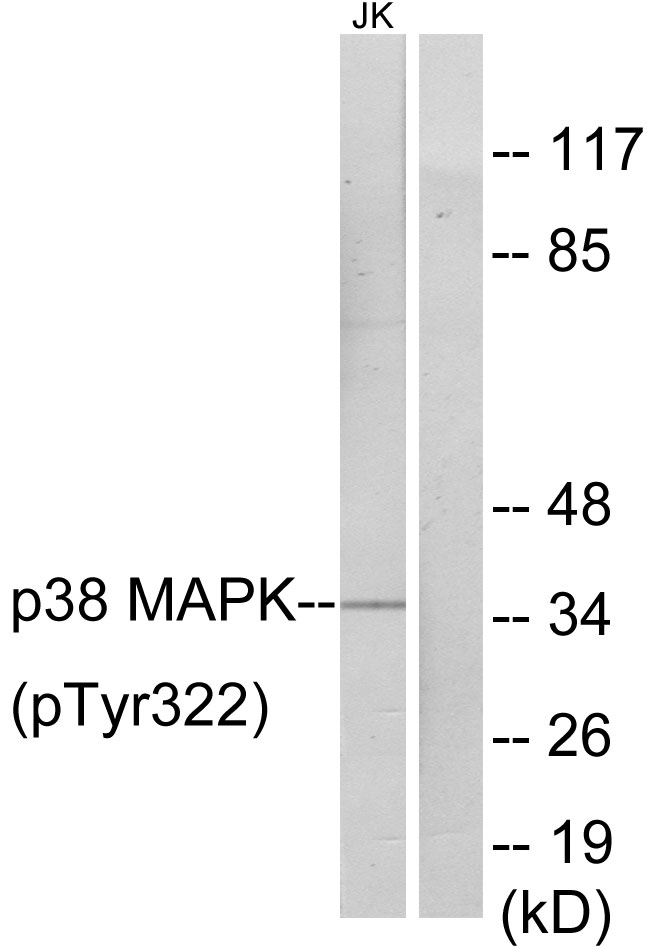 MAPK14 / p38 Antibody - Western blot analysis of lysates from Jurkat cells, using p38 MAPK (Phospho-Tyr322) Antibody. The lane on the right is blocked with the phospho peptide.