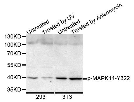 MAPK14 / p38 Antibody - Western blot analysis of extracts of various cell lines.