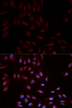 MAPK14 / p38 Antibody - Immunofluorescence analysis of U2OS cells.