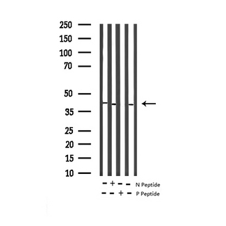 MAPK14 / p38 Antibody - Western blot analysis of Phospho-p38 MAPK (Tyr323) expression in various lysates