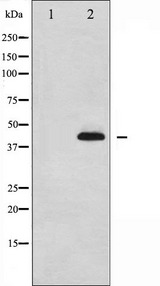 MAPK14 / p38 Antibody - Western blot analysis of p38 MAPK phosphorylation expression in Jurkat whole cells lysates. The lane on the left is treated with the antigen-specific peptide.