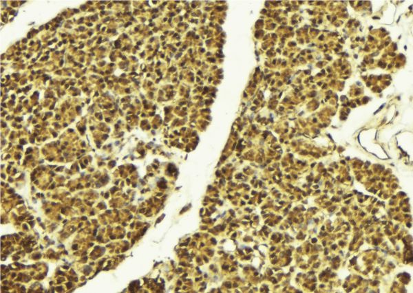 MAPK14 / p38 Antibody - 1:100 staining mouse pancreas tissue by IHC-P. The sample was formaldehyde fixed and a heat mediated antigen retrieval step in citrate buffer was performed. The sample was then blocked and incubated with the antibody for 1.5 hours at 22°C. An HRP conjugated goat anti-rabbit antibody was used as the secondary.
