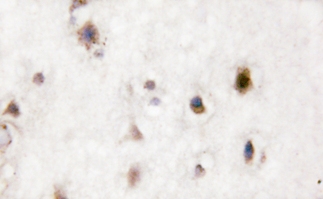 MAPK14 / p38 Antibody - 1/100 staining human brain tissue by IHC-P. The sample was formaldehyde fixed and a heat mediated antigen retrieval step in citrate buffer was performed. The sample was then blocked and incubated with the antibody for 1.5 hours at 22°C. An HRP conjugated goat anti-rabbit antibody was used as the secondary antibody.