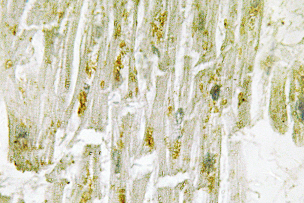 MAPK14 / p38 Antibody - IHC of p38 (T175) pAb in paraffin-embedded human heart tissue.