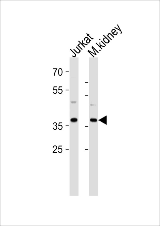 MAPK14 / p38 Antibody - MAPK14 Antibody (Y322) western blot of Jurkat cell line and mouse kidney tissue lysates (35 ug/lane). The MAPK14 antibody detected the MAPK14 protein (arrow).