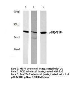 MAPK14 / p38 Antibody - Western blot of p38 (V318) pAb in extracts from MCF7 (treated with UV), PC12 (treated with IL-1), Raw264.7 (treated with IL-1) cells.