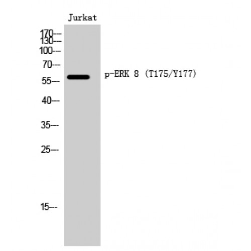 MAPK15 / ERK7 Antibody - Western blot of Phospho-ERK 8 (T175/Y177) antibody