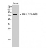 MAPK15 / ERK7 Antibody - Western blot of Phospho-ERK 8 (T175/Y177) antibody