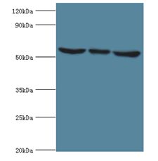 MAPK15 / ERK7 Antibody - Western blot. All lanes: MAPK15 antibody at 6 ug/ml. Lane 1: HeLa whole cell lysate. Lane 2: MCF-7 whole cell lysate. Lane 3: HepG2 whole cell lysate. Secondary antibody: Goat polyclonal to rabbit at 1:10000 dilution. Predicted band size: 60 kDa. Observed band size: 60 kDa.
