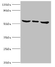 MAPK15 / ERK7 Antibody - Western blot All lanes: MAPK15 antibody at 6µg/ml Lane 1: Hela whole cell lysate Lane 2: MCF-7 whole cell lysate Lane 3: HepG2 whole cell lysate Secondary Goat polyclonal to rabbit IgG at 1/10000 dilution Predicted band size: 60, 29, 32 kDa Observed band size: 60 kDa