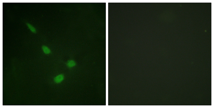 MAPK15 / ERK7 Antibody - Immunofluorescence analysis of NIH/3T3 cells, using ERK8 Antibody. The picture on the right is blocked with the synthesized peptide.