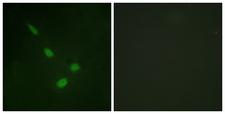MAPK15 / ERK7 Antibody - Immunofluorescence analysis of NIH/3T3 cells, using ERK8 Antibody. The picture on the right is blocked with the synthesized peptide.
