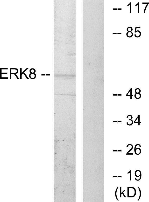 MAPK15 / ERK7 Antibody - Western blot analysis of lysates from HepG2 cells, using ERK8 Antibody. The lane on the right is blocked with the synthesized peptide.