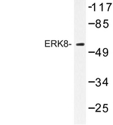 MAPK15 / ERK7 Antibody - Western blot of ERK8 (D171) pAb in extracts from HepG2 cells.