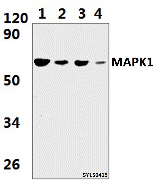 MAPK15 / ERK7 Antibody - Western blot of MAPK15 antibody at 1:1000 dilution. Lane 1: HELA whole cell lysate (51.3ug). Lane 2: The Lung tissue lysate of Rat (39.4ug). Lane 3: The Lung tissue lysate of Mouse (39.4ug). Lane 4: A549 whole cell lysate (57.6ug).
