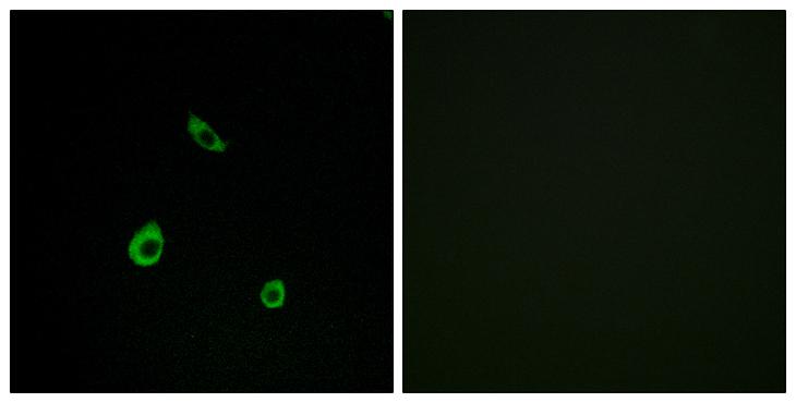 MAPK15 / ERK7 Antibody - Peptide - + Immunofluorescence analysis of LOVO cells, using MAPK15 antibody.