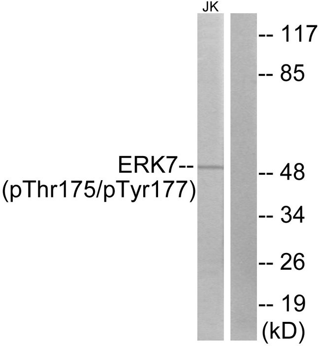 MAPK15 / ERK7 Antibody - Western blot analysis of lysates from Jurkat cells, using ERK8 (Phospho-Thr175+Tyr177) Antibody. The lane on the right is blocked with the phospho peptide.