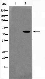 MAPK15 / ERK7 Antibody - Western blot of Jurkat cell lysate using Phospho-ERK8(Thr175+Tyr177) Antibody