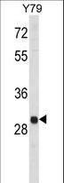 MAPK1IP1L Antibody - Western blot of MAPK1IP1L Antibody in Y79 cell line lysates (35 ug/lane). MAPK1IP1L (arrow) was detected using the purified antibody.