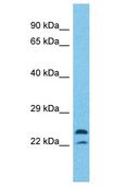 MAPK1IP1L Antibody - MAPK1IP1L antibody Western Blot of HT1080. Antibody dilution: 1 ug/ml.  This image was taken for the unconjugated form of this product. Other forms have not been tested.