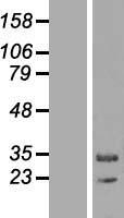 MAPK1IP1L Protein - Western validation with an anti-DDK antibody * L: Control HEK293 lysate R: Over-expression lysate