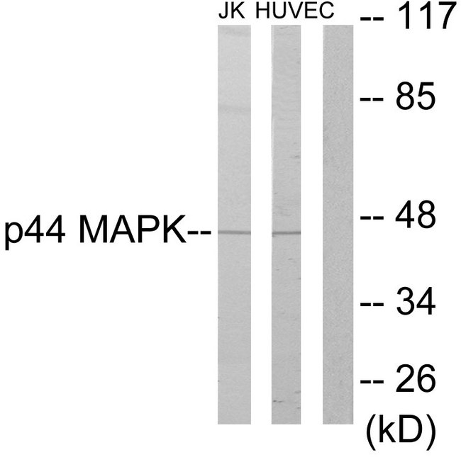MAPK3 / ERK1 Antibody - Western blot analysis of lysates from Jurkat and HUVEC cells, using p44 MAPK Antibody. The lane on the right is blocked with the synthesized peptide.