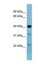 MAPK3 / ERK1 Antibody - MAPK3 / ERK1 antibody Western blot of Fetal Lung lysate. This image was taken for the unconjugated form of this product. Other forms have not been tested.
