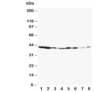MAPK3 / ERK1 Antibody - Western blot testing of ERK1 antibody and Lane 1: rat spleen; 2: rat thymus; 3: rat skeletal muscle; 4: rat kidney; 5: HeLa; 6: Jurkat; 7: Raji; 8: COLO320