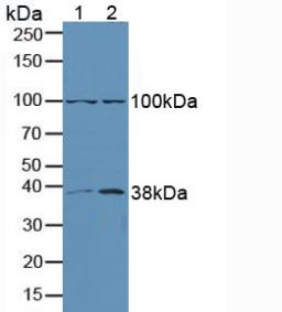 MAPK3 / ERK1 Antibody - Western Blot; Sample: Lane1: Human A549 Cells; Lane2: Human Lung Tissue.