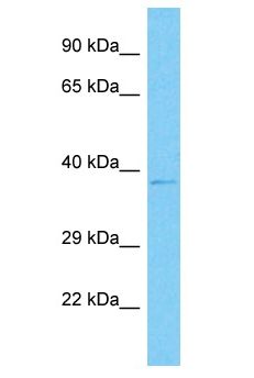 MAPK3 / ERK1 Antibody - MAPK3 / ERK1 antibody Western Blot of Jurkat. Antibody dilution: 1 ug/ml.  This image was taken for the unconjugated form of this product. Other forms have not been tested.