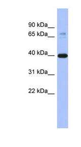 MAPK3 / ERK1 Antibody - MAPK3 / ERK1 antibody Western blot of Fetal Brain lysate. This image was taken for the unconjugated form of this product. Other forms have not been tested.