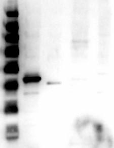 MAPK3 / ERK1 Antibody - Western Blot of Anti-ERK1 C Term Antibody. Lane 1: MW. Lane 2: ERK1 lysate. Lane 3: ERK2 lysate. Lane 4: Mouse Brain Whole cell Lysate. Lane 5: HEK293 Whole Cell Lysate. Load: 10ng. Primary Antibody: Anti-ERK1 at 1µg/mL overnight at 4°C. Secondary Antibody: Goat anti-Rabbit Peroxidase Conjugated Antibody 1:40,000 for 30 min at RT. Blocking: BlockOut Universal Blocking buffer MB-073. Predicted MW: 43kDa in Lane 1.