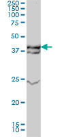 MAPK3 / ERK1 Antibody - MAPK3 monoclonal antibody Western blot of MAPK3 expression in A-431.