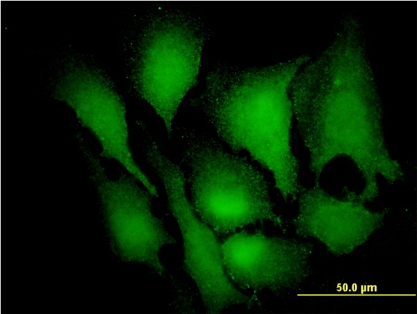 MAPK3 / ERK1 Antibody - Immunofluorescence of monoclonal antibody to MAPK3 on HeLa cell. [antibody concentration 25 ug/ml]